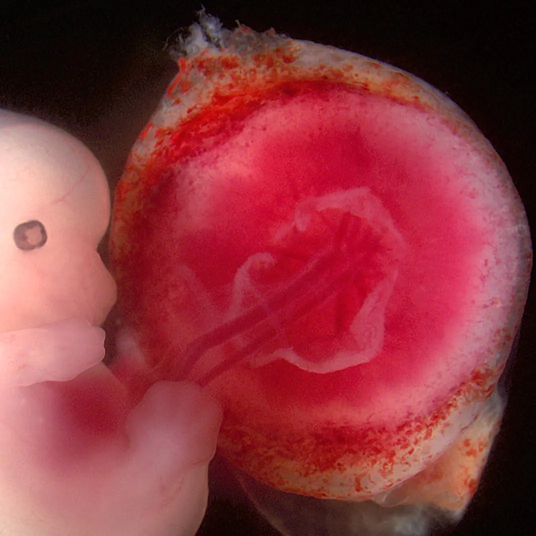 Fetus_and_placenta