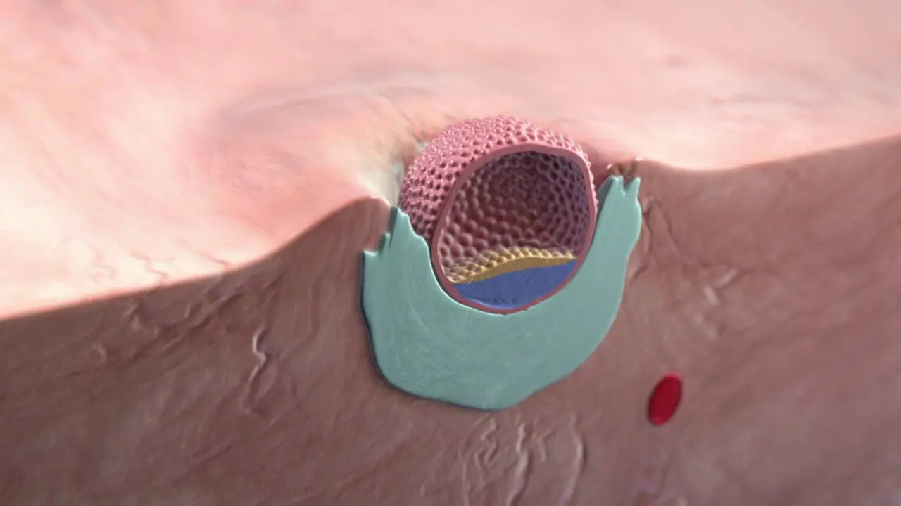 implantation of a blastocyst